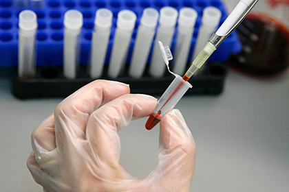 Антитела к ВИЧ впервые успешно испытали на людях