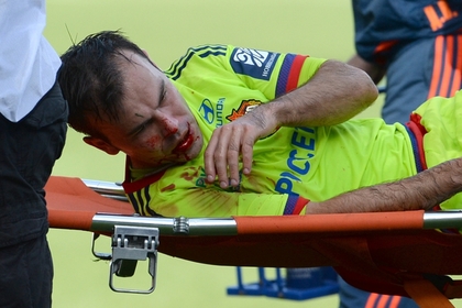 Футболист ЦСКА получил закрытую черепно-мозговую травму и сотрясение мозга