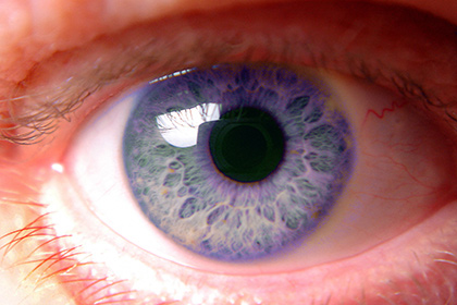 Найдено лекарство от рака глаза