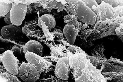Ученые нашли связь между «Черной смертью» и современной чумой