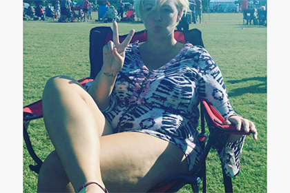 Женщины выставили в Instagram снимки своего целлюлита