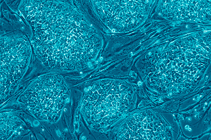 Ученые обратили вспять старение стволовых клеток