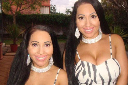 Потратившие 250 тысяч долларов на пластику близнецы пожалели о своем сходстве