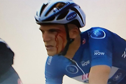 Украинский велогонщик разбил лицо лидеру многодневки «Тур Дубая»