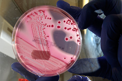 ВОЗ назвала 12 самых опасных для человека бактерий