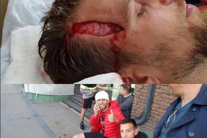 Аргентинский футболист получил пробоину в голове после столкновения с игроками