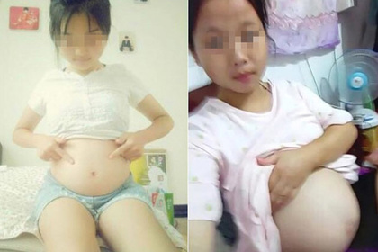 Хвастающиеся беременными животами девочки-подростки шокировали интернет