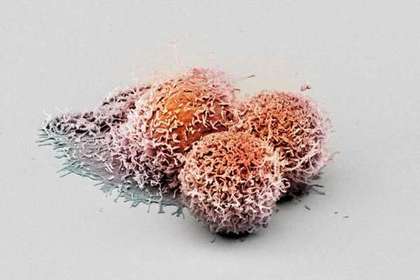Обнаружено подавляющее развитие рака средство