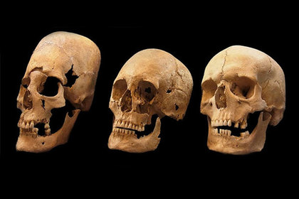 Раскрыта загадка древних вытянутых черепов