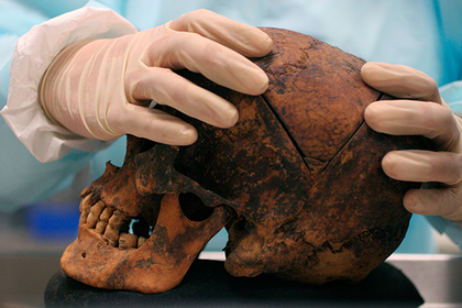 В зубах древнего человека нашли смертоносный вирус