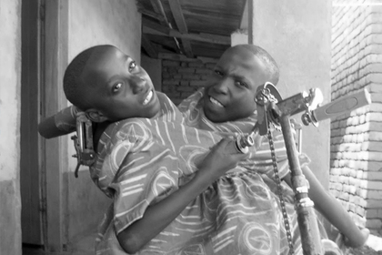 В Танзании в возрасте 21 года умерли популярные сиамские близнецы