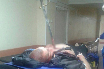 Мужчина со старинной саблей в груди попал в московскую больницу
