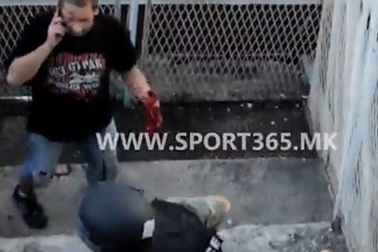 Македонскому болельщику оторвало руку взрывом гранаты
