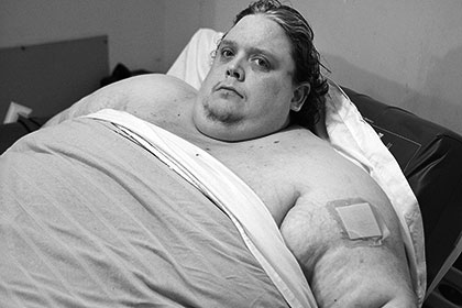 Умер самый толстый человек в мире