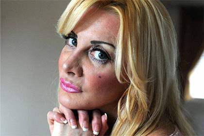 Потратившая 700 тысяч долларов на пластику британка выучилась на косметолога