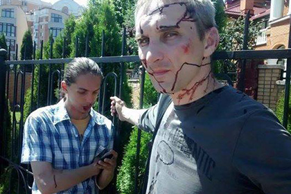 Активисты одесского Майдана посоветовали участникам гей-парада «беречь задницы»