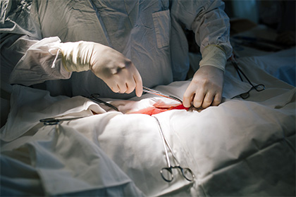 Хирурга из Кемерово отдали под суд за смерть пациента после операции