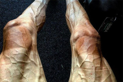 Состояние ног участника «Тур де Франс» ужаснуло его подписчиков