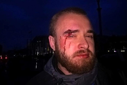В Киеве возле памятника Небесной сотне избили «киборга» Бизона
