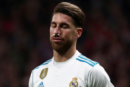 Сломавший нос игрок «Реала» выразил готовность еще тысячу раз истечь кровью