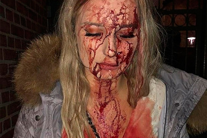 В «мигрантской столице» Швеции женщину избили бутылкой до крови за отказ в сексе