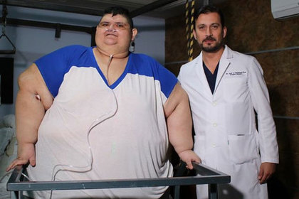 Самый толстый человек похудел