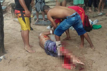Бразилец лишился ноги после нападения акулы