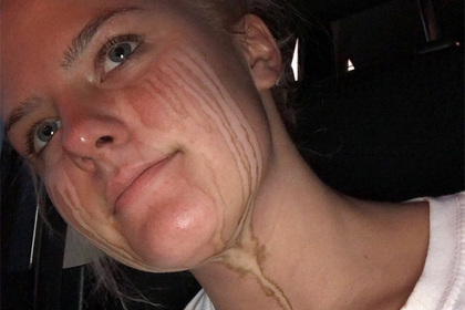 Злоупотребившая загаром девушка увековечила слезы на лице