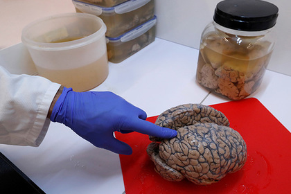 В мозге нашли источник человеческого сознания